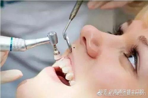 成人洗牙搞笑视频,笑料百出，成人洗牙搞笑瞬间大盘点！